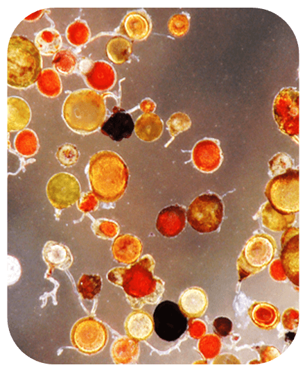 Spores mycorhiziennes colorées au microscope